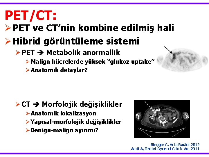 PET/CT: Ø PET ve CT’nin kombine edilmiş hali Ø Hibrid görüntüleme sistemi Ø PET