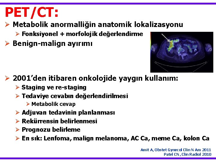 PET/CT: Ø Metabolik anormalliğin anatomik lokalizasyonu Ø Fonksiyonel + morfolojik değerlendirme Ø Benign-malign ayırımı