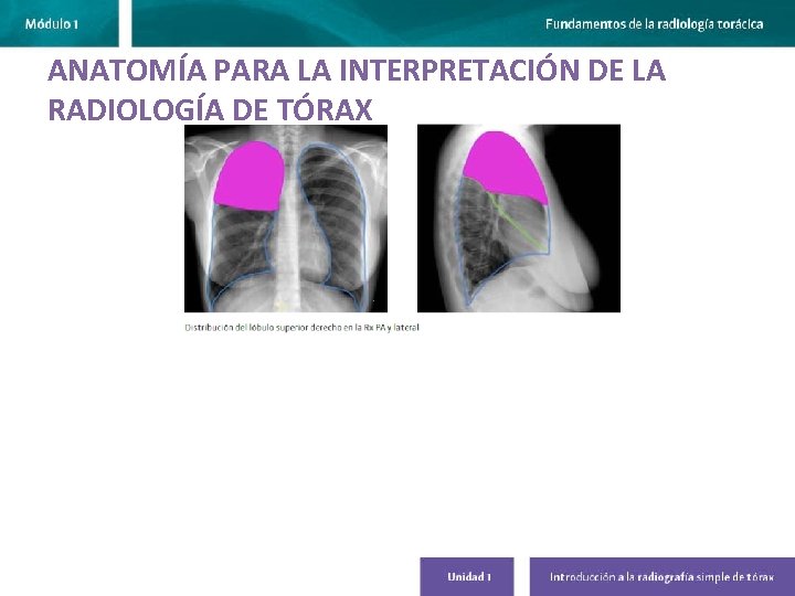 ANATOMÍA PARA LA INTERPRETACIÓN DE LA RADIOLOGÍA DE TÓRAX 