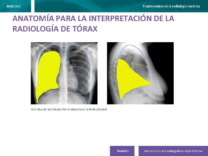 ANATOMÍA PARA LA INTERPRETACIÓN DE LA RADIOLOGÍA DE TÓRAX 
