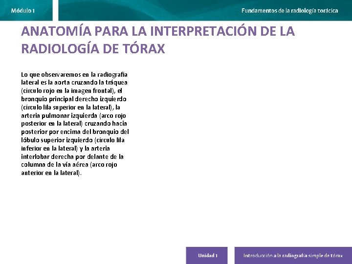 ANATOMÍA PARA LA INTERPRETACIÓN DE LA RADIOLOGÍA DE TÓRAX Lo que observaremos en la