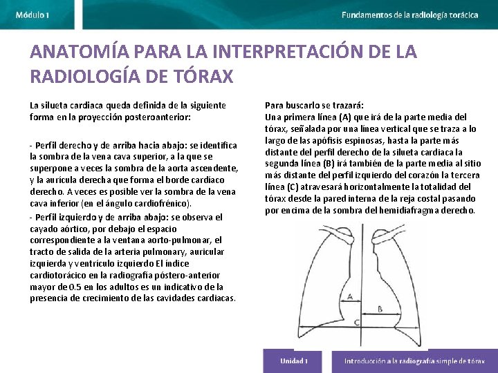 ANATOMÍA PARA LA INTERPRETACIÓN DE LA RADIOLOGÍA DE TÓRAX La silueta cardiaca queda definida