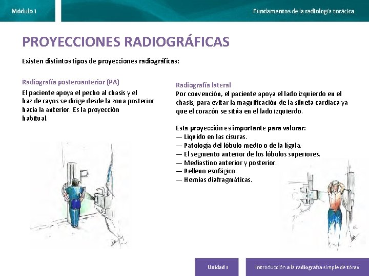 PROYECCIONES RADIOGRÁFICAS Existen distintos tipos de proyecciones radiográficas: Radiografía posteroanterior (PA) El paciente apoya