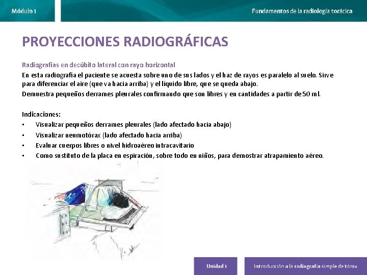 PROYECCIONES RADIOGRÁFICAS Radiografías en decúbito lateral con rayo horizontal En esta radiografía el paciente