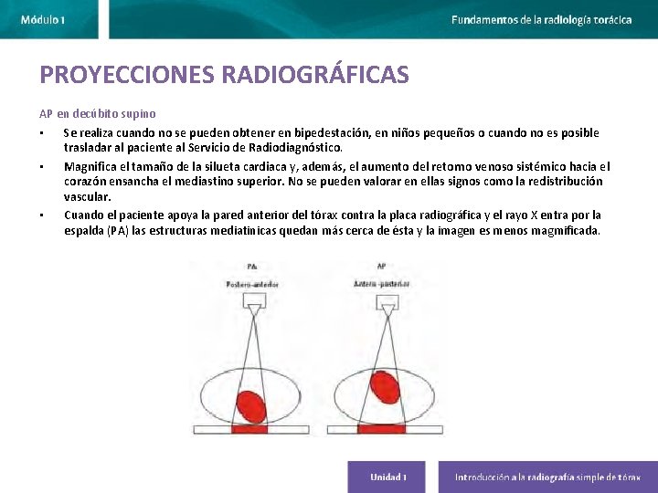 PROYECCIONES RADIOGRÁFICAS AP en decúbito supino • Se realiza cuando no se pueden obtener