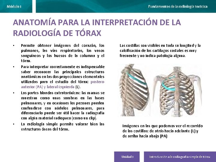 ANATOMÍA PARA LA INTERPRETACIÓN DE LA RADIOLOGÍA DE TÓRAX • • Permite obtener imágenes