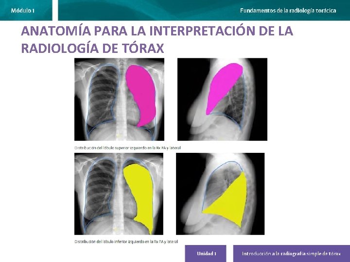 ANATOMÍA PARA LA INTERPRETACIÓN DE LA RADIOLOGÍA DE TÓRAX 