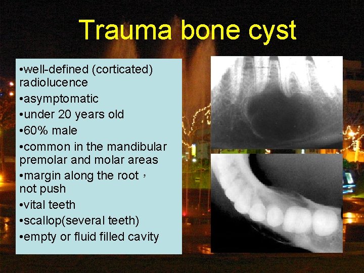 Trauma bone cyst • well-defined (corticated) radiolucence • asymptomatic • under 20 years old