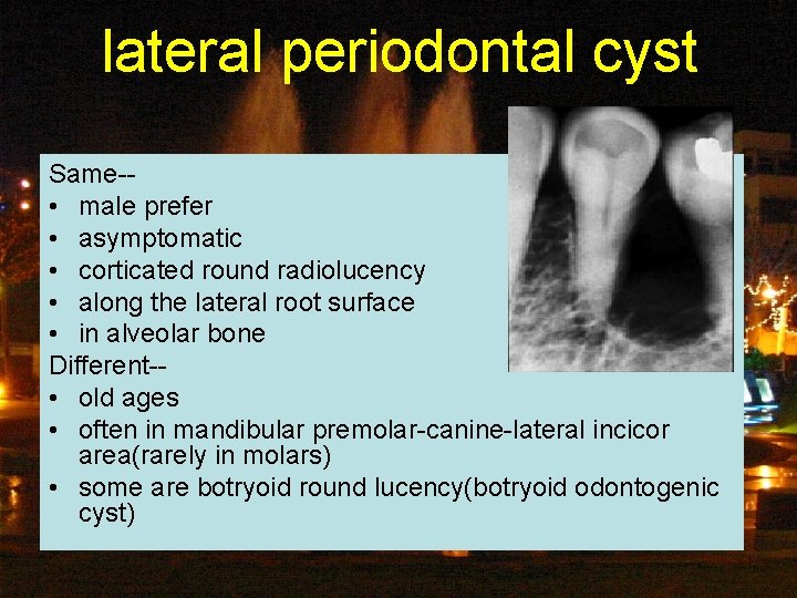 lateral periodontal cyst Same-- • male prefer • asymptomatic • corticated round radiolucency •