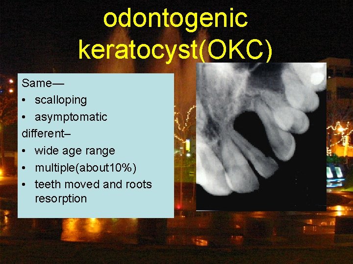 odontogenic keratocyst(OKC) Same— • scalloping • asymptomatic different– • wide age range • multiple(about