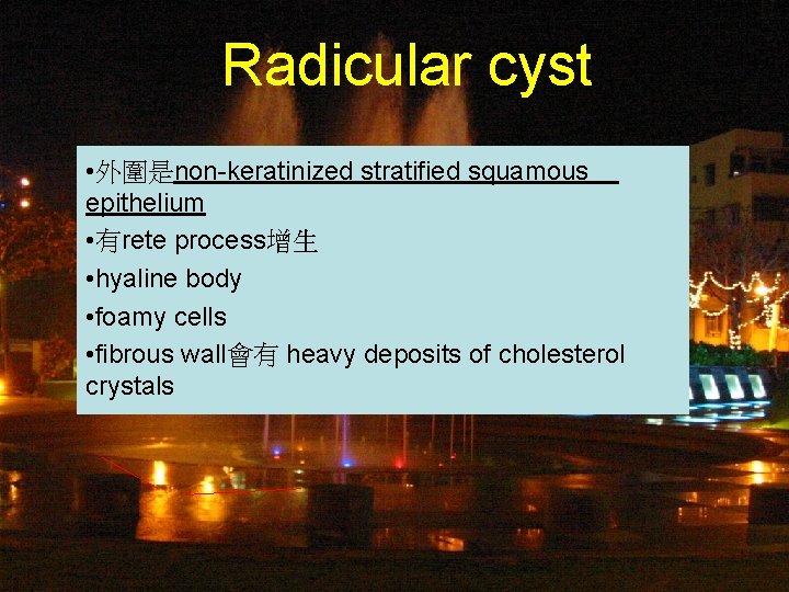 Radicular cyst • 外圍是non-keratinized stratified squamous epithelium • 有rete process增生 • hyaline body •