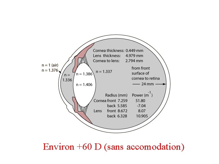 Environ +60 D (sans accomodation) 