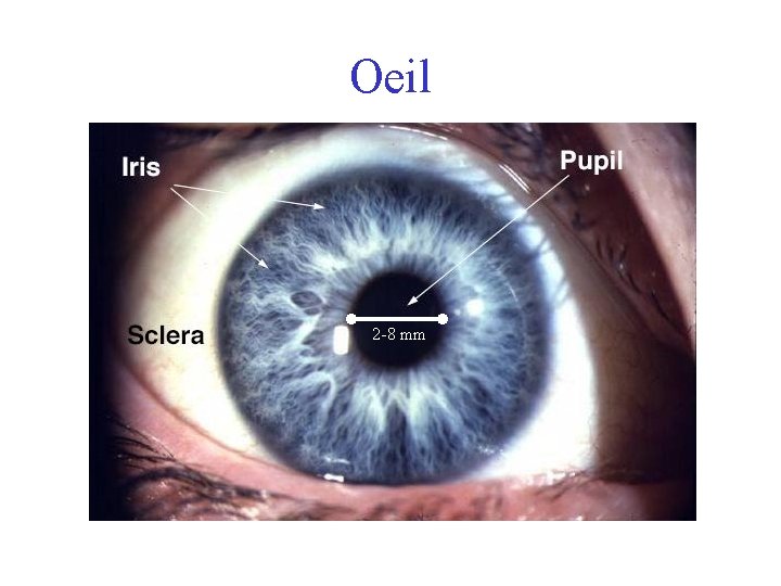 Oeil 2 -8 mm 
