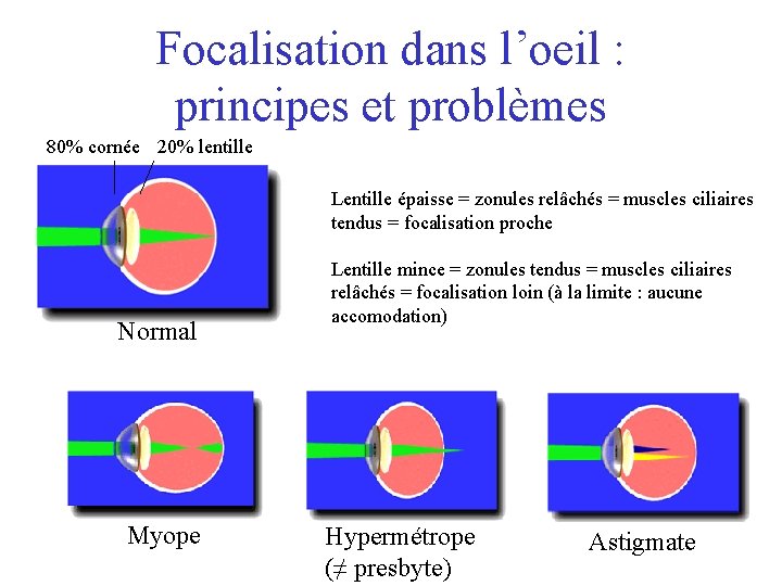Focalisation dans l’oeil : principes et problèmes 80% cornée 20% lentille Lentille épaisse =