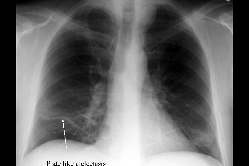 Chest XRays Every Resident Should Know Part 1