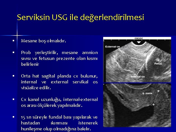 Serviksin USG ile değerlendirilmesi Mesane boş olmalıdır. Prob yerleştirilir, mesane amnion sıvısı ve fetusun Serviksin USG ile değerlendirilmesi Mesane boş olmalıdır. Prob yerleştirilir, mesane amnion sıvısı ve fetusun