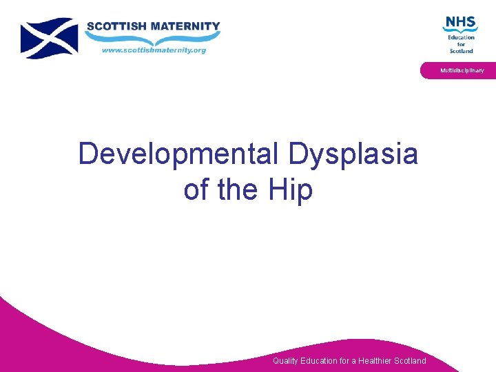 Multidisciplinary Developmental Dysplasia of the Hip Quality Education for a Healthier Scotland 