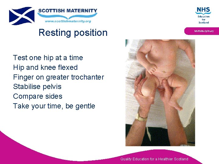 Resting position Multidisciplinary Test one hip at a time Hip and knee flexed Finger