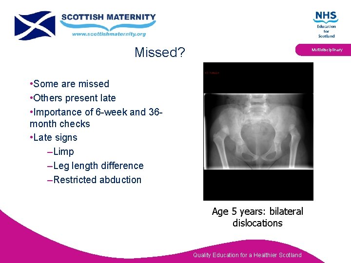 Missed? Multidisciplinary • Some are missed • Others present late • Importance of 6