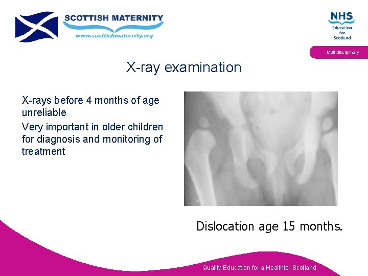 Multidisciplinary X-ray examination X-rays before 4 months of age unreliable Very important in older