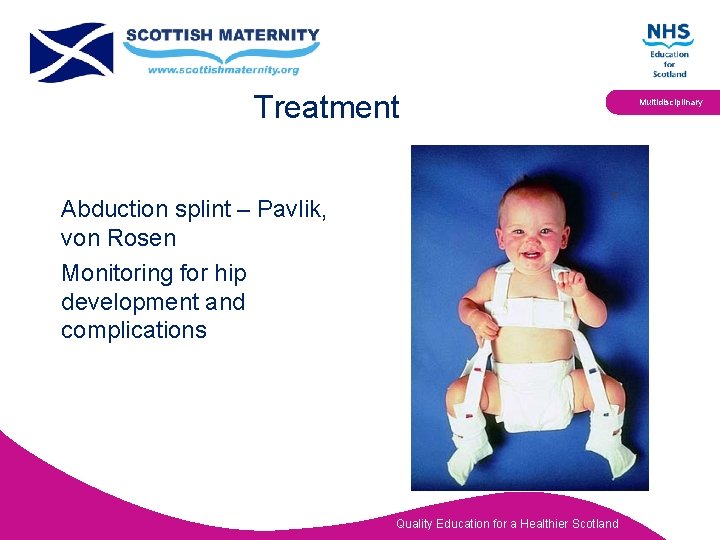 Treatment Abduction splint – Pavlik, von Rosen Monitoring for hip development and complications Quality