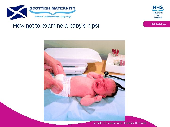 How not to examine a baby’s hips! Quality Education for a Healthier Scotland Multidisciplinary