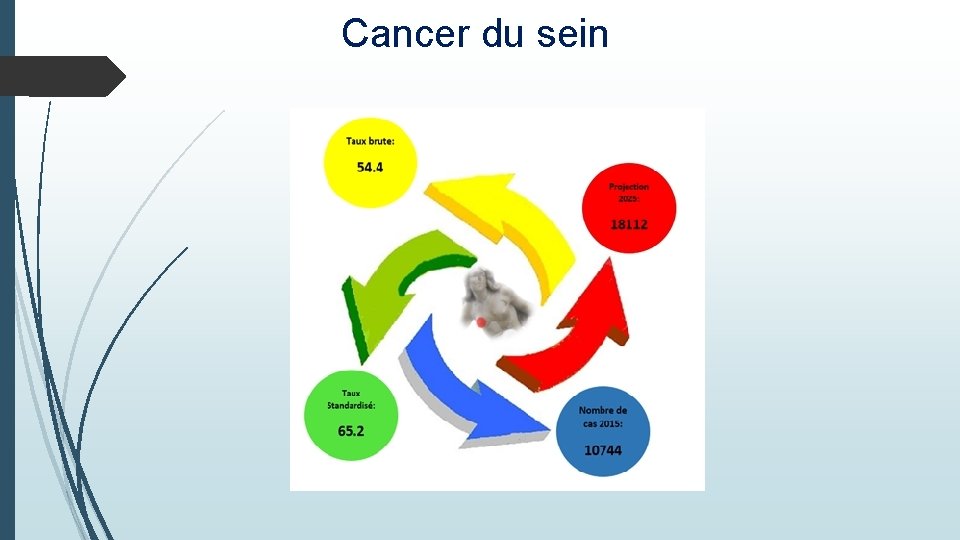 Cancer du sein 