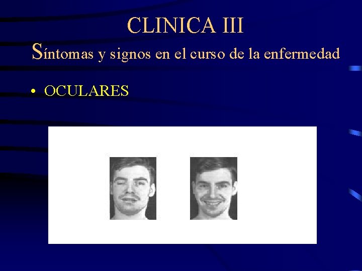 CLINICA III Síntomas y signos en el curso de la enfermedad • OCULARES 