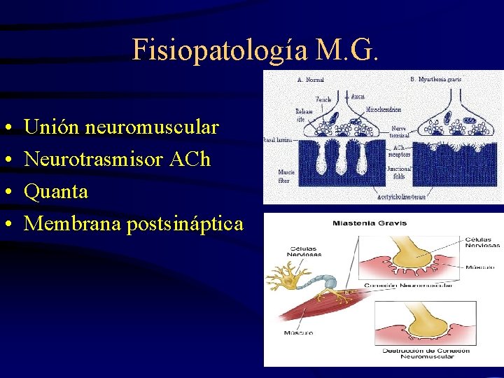  Fisiopatología M. G. • • Unión neuromuscular Neurotrasmisor ACh Quanta Membrana postsináptica 