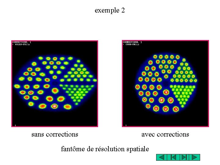 exemple 2 sans corrections avec corrections fantôme de résolution spatiale 