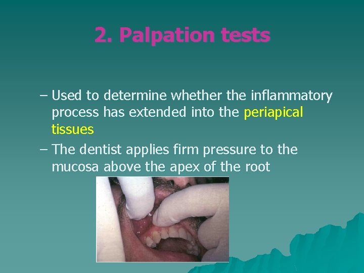 2. Palpation tests – Used to determine whether the inflammatory process has extended into 2. Palpation tests – Used to determine whether the inflammatory process has extended into