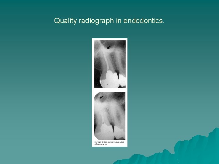 Quality radiograph in endodontics. Quality radiograph in endodontics.