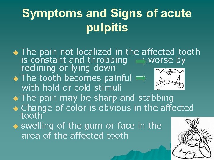 Symptoms and Signs of acute pulpitis The pain not localized in the affected tooth Symptoms and Signs of acute pulpitis The pain not localized in the affected tooth
