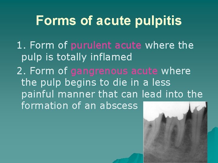 Forms of acute pulpitis 1. Form of purulent acute where the pulp is totally Forms of acute pulpitis 1. Form of purulent acute where the pulp is totally