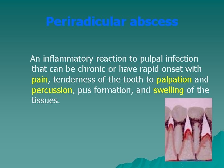 Periradicular abscess An inflammatory reaction to pulpal infection that can be chronic or have Periradicular abscess An inflammatory reaction to pulpal infection that can be chronic or have
