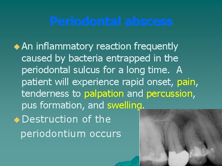 Periodontal abscess u An inflammatory reaction frequently caused by bacteria entrapped in the periodontal Periodontal abscess u An inflammatory reaction frequently caused by bacteria entrapped in the periodontal