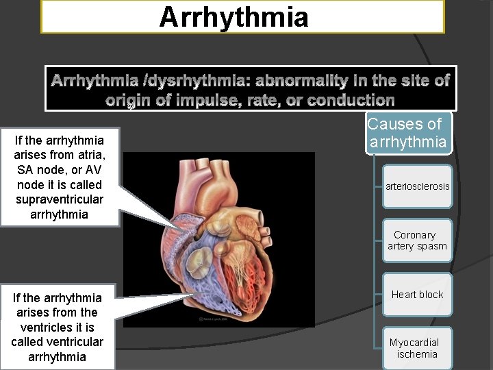 Arrhythmia If the arrhythmia arises from atria, SA node, or AV node it is