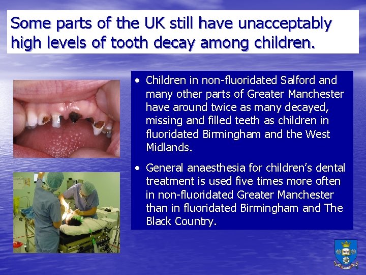 Some parts of the UK still have unacceptably high levels of tooth decay among