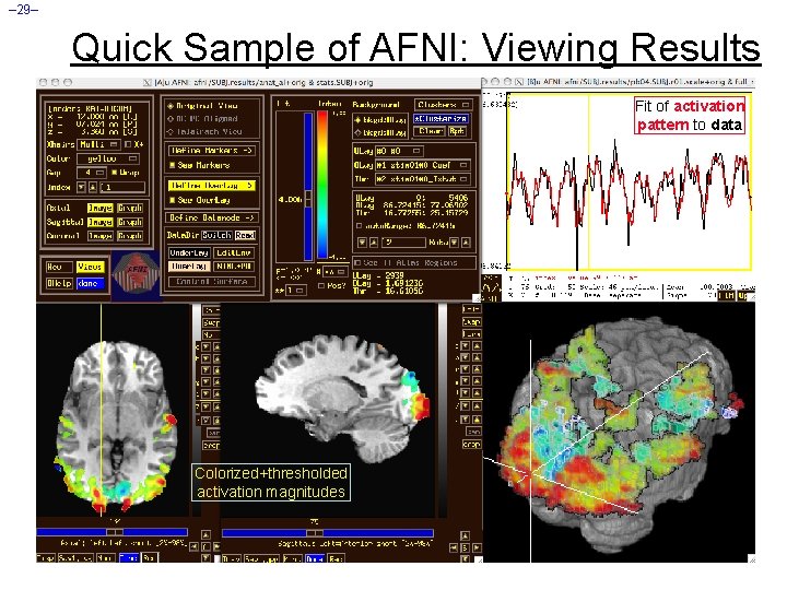 – 29– Quick Sample of AFNI: Viewing Results Fit of activation pattern to data