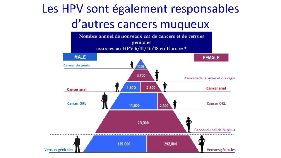 Les HPV sont également responsables d’autres cancers muqueux 