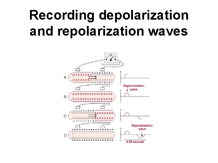 Recording depolarization and repolarization waves 
