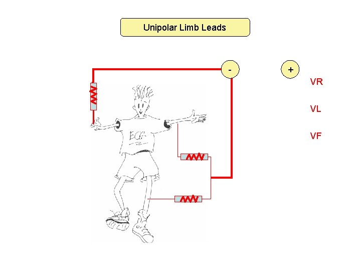 Unipolar Limb Leads - + VR VL VF 