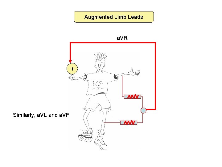 Augmented Limb Leads a. VR + Similarly, a. VL and a. VF 