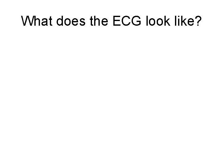 What does the ECG look like? 