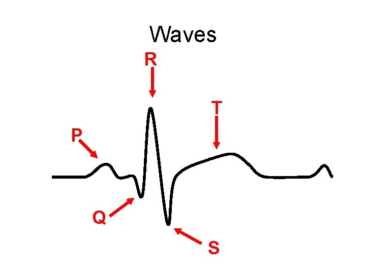 Waves R T P Q S 