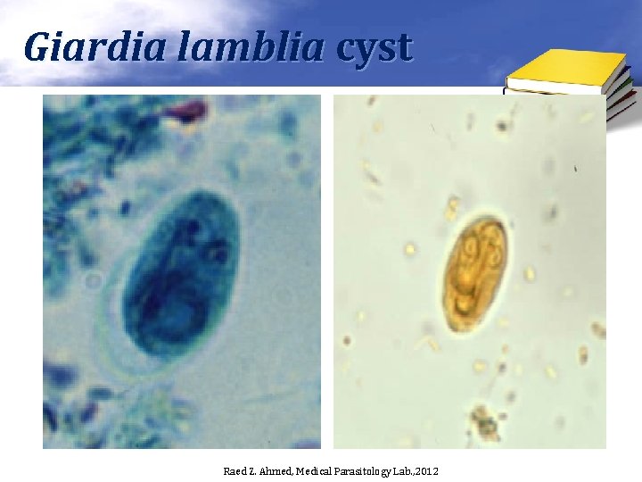 Giardia lamblia cyst Raed Z. Ahmed, Medical Parasitology Lab. , 2012 