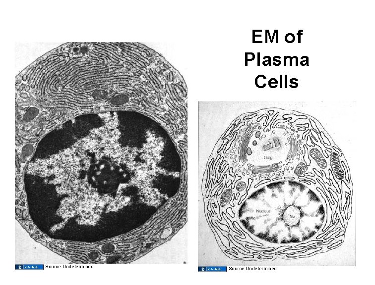 EM of Plasma Cells Source Undetermined 