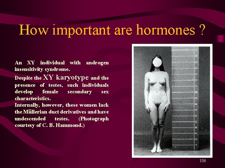 How important are hormones ? An XY individual with androgen insensitivity syndrome. Despite the How important are hormones ? An XY individual with androgen insensitivity syndrome. Despite the