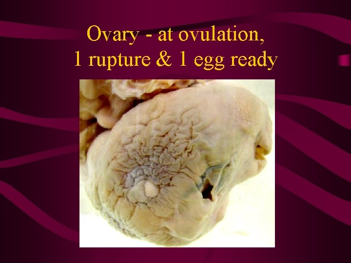 Ovary - at ovulation, 1 rupture & 1 egg ready 