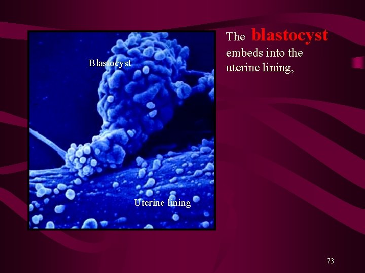 The blastocyst embeds into the uterine lining, Blastocyst Uterine lining 73 